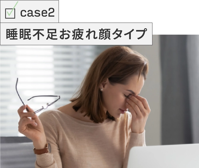 case02 睡眠不足お疲れ顔タイプ